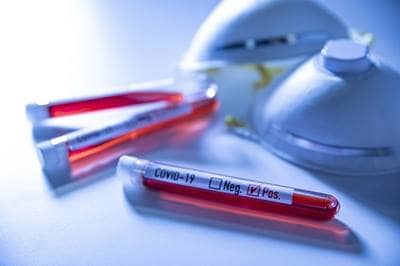 Coronavirus-COVID-19